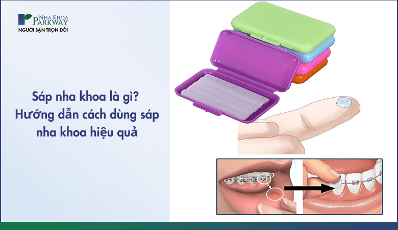 sáp nha khoa và cách dùng