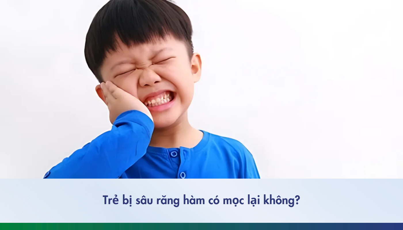 Trẻ bị sâu răng hàm có mọc lại không và cách xử lý