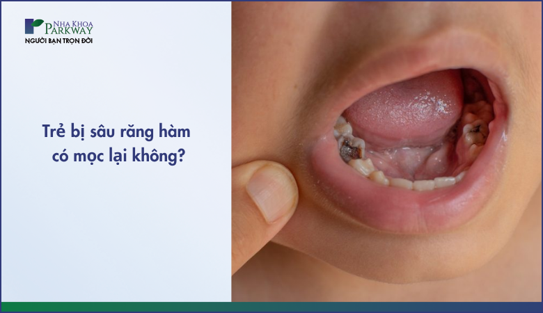 trẻ sâu răng hàm có mọc lại không