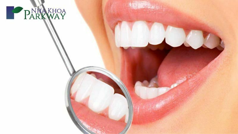 Nguyên nhân và khắc phục bọc răng sứ phần chân răng bị hở