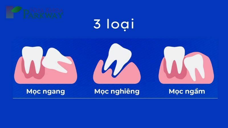 Răng số 8 là răng gì?