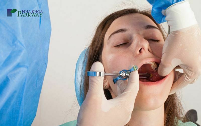 Cách chữa trị việc răng bị đen