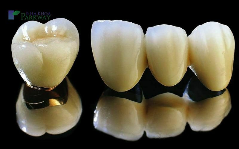 Cách chữa trị việc răng bị đen