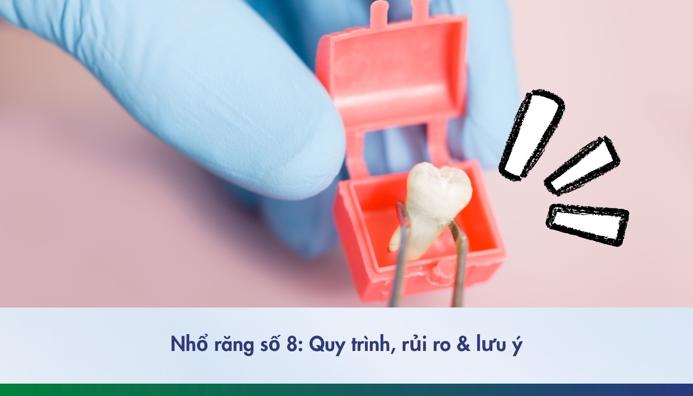 Nhổ răng số 8: Quy trình và những điều cần biết