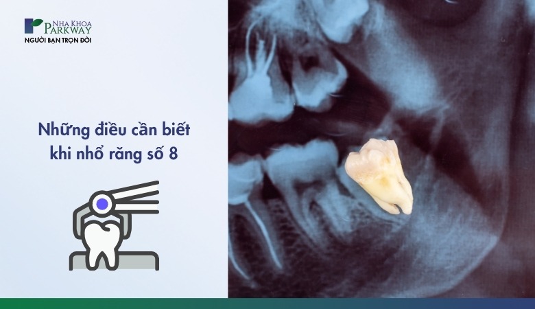 Quy trình nhổ răng số 8