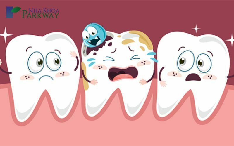 Những tác hại của răng thưa gây ra