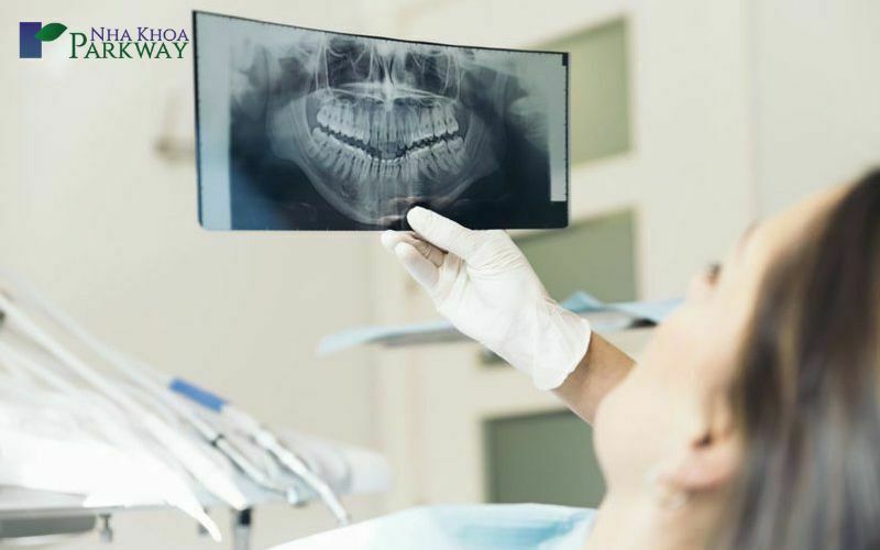Kiểm tra tổng quát tình trạng răng miệng và chụp X quang