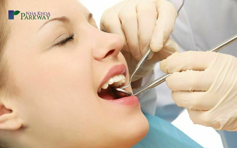 Cách làm sạch cao răng đen tại nha khoa