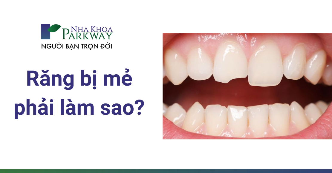 Bị mẻ răng có sao không? Răng bị mẻ phải làm sao?