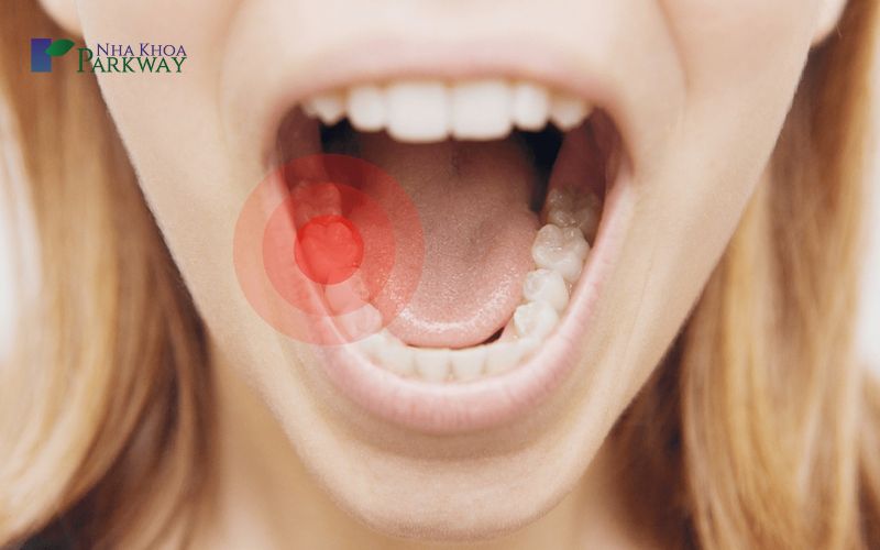 Những triệu chứng của răng sâu lỗ to