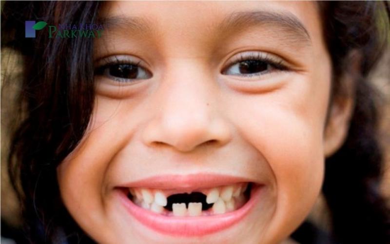 Độ tuổi trẻ em thay răng sữa bằng răng vĩnh viễn