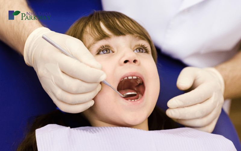 Cách chữa sâu răng khoa học theo từng giai đoạn