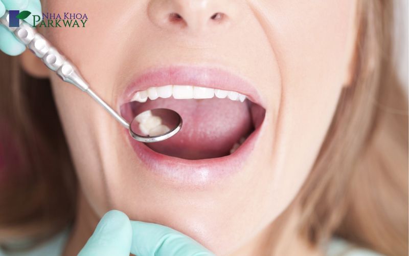 Phương pháp chữa trị răng sâu hiện nay tại nha khoa