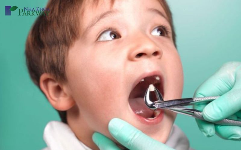 Cách để phòng tránh trẻ bị sâu răng sữa