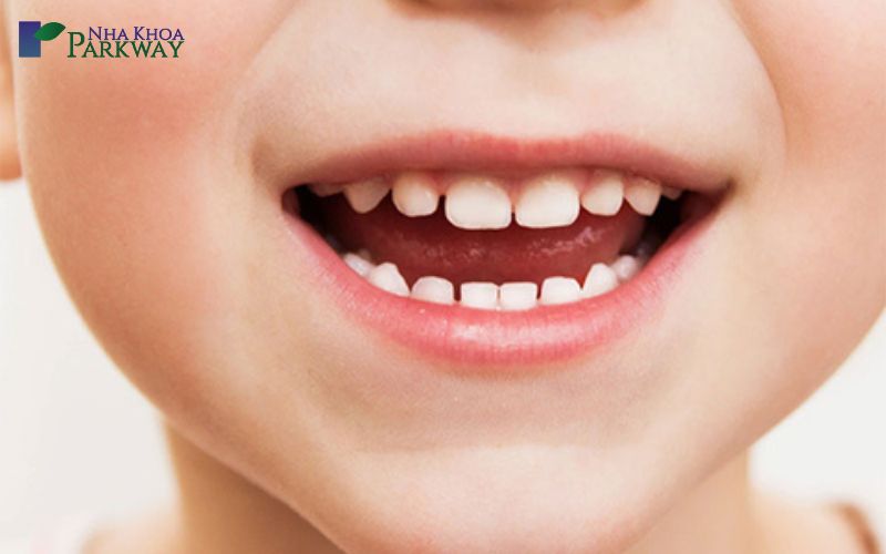 Những đặc điểm thường thấy răng sữa 
