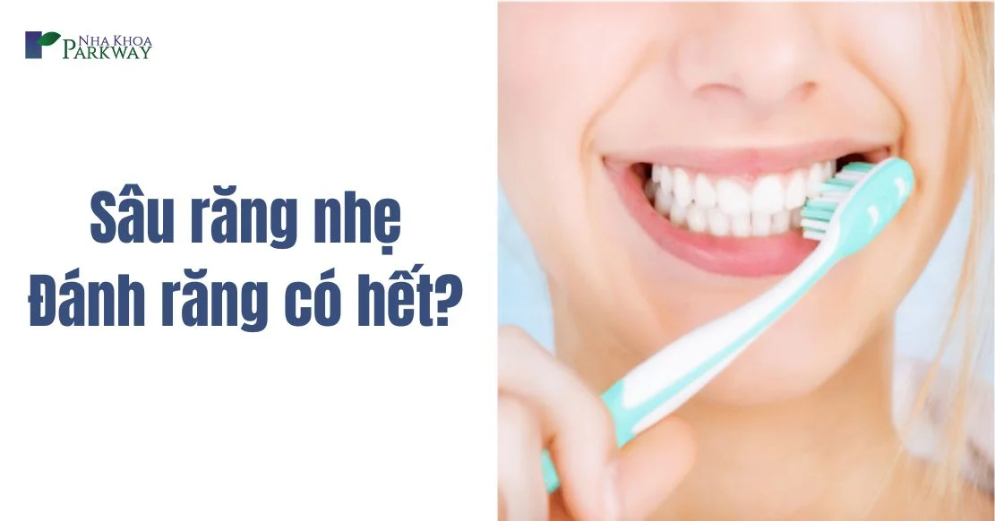 Thắc mắc bị sâu răng nhẹ đánh răng có hết không?