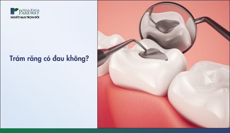 Trám răng có đau không
