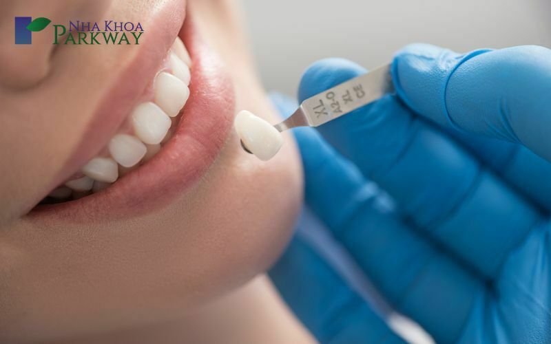 Cách điều trị hiệu quả nhanh chóng tình trạng răng cửa bị thưa tại nha khoa