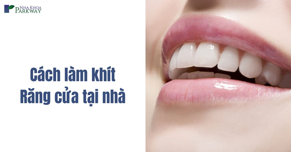 Cách làm khít răng cửa tại nhà đơn giản nhưng hiệu quả