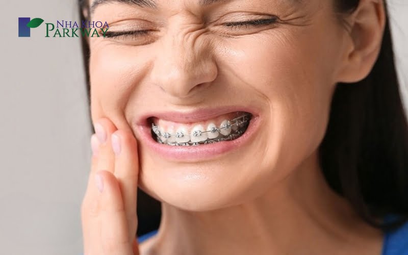 Những vấn đề có thể gặp trong suốt quá trình đóng khoảng răng 