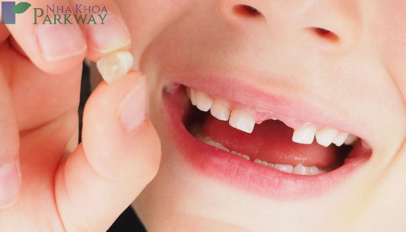 Răng sữa được nhổ sớm thì răng vĩnh viễn có mọc sớm hay không?