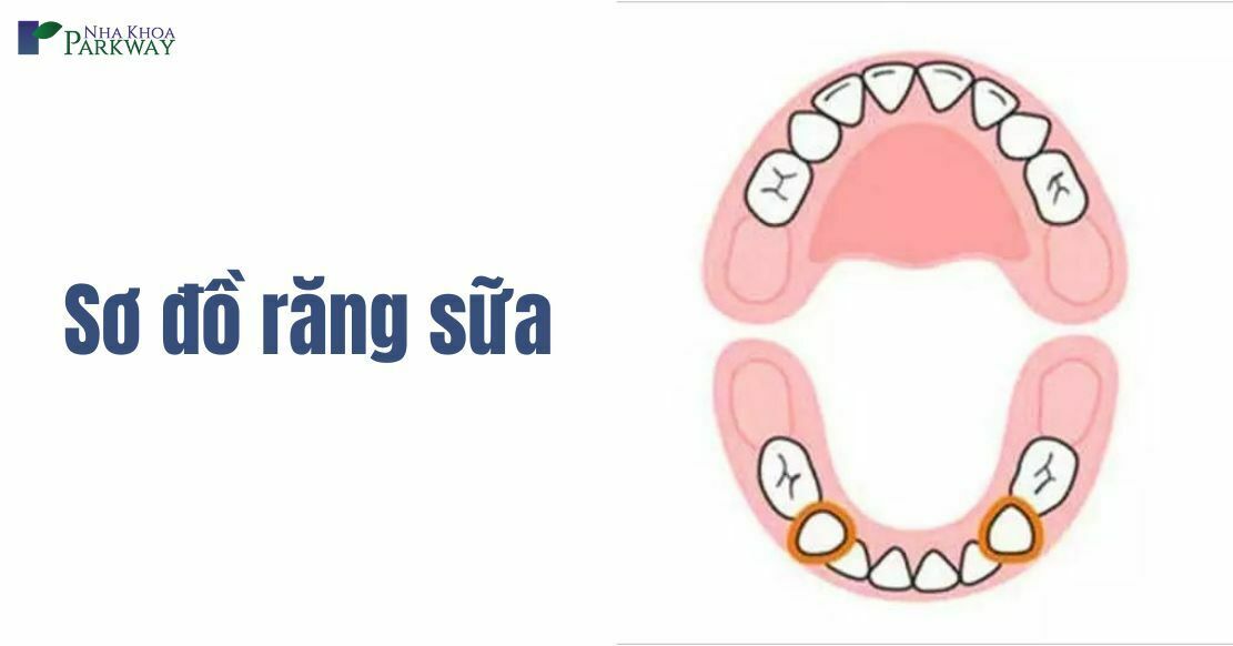 Sơ đồ răng sữa và cách đọc tên hàm răng sữa