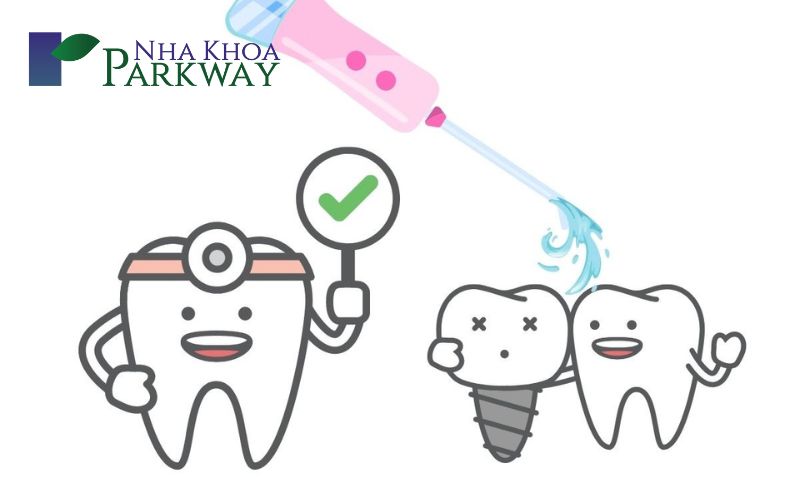 Những cách chăm sóc răng miệng khi bị viêm lợi răng hàm