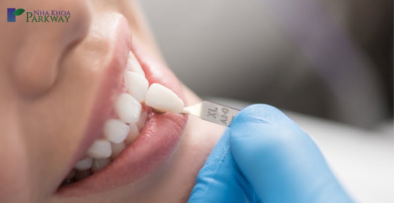 Cách dán răng giả bị rớt tại nha khoa