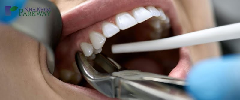 Cách khắc phục cho người bị ê răng hàm dưới