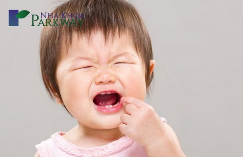 Nguyên nhân gây đau răng hàm ở bé