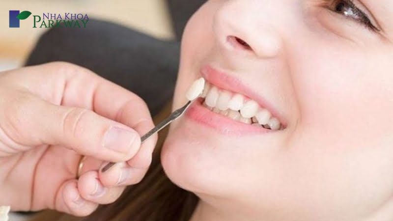 Răng khểnh có nên giữ lại không? 
