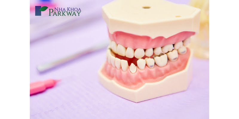 Trồng răng giả có ảnh hưởng gì không?