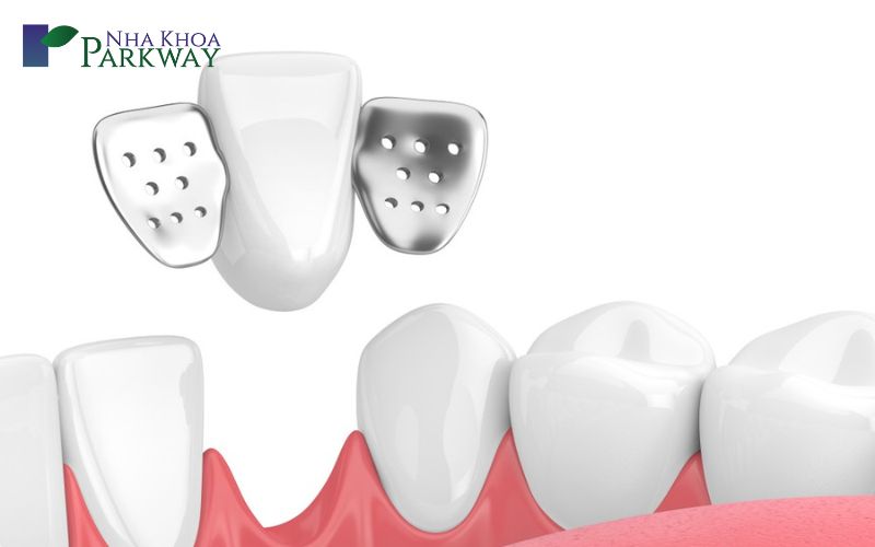 Có những loại răng giả tạm thời nào?