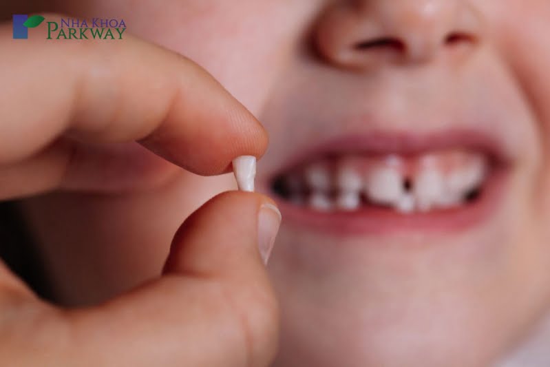 Trẻ nhỏ nhổ răng sữa bao lâu mọc lại?