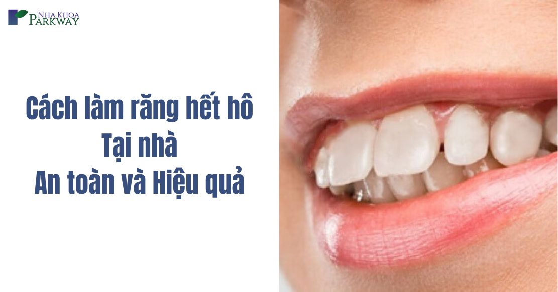 Top 4 Cách làm răng hết hô tại nhà nhanh nhất