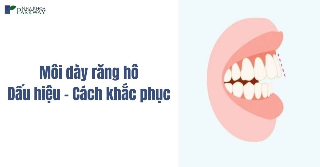 Môi dày răng hô: Dấu hiệu và cách khắc phục hiệu quả