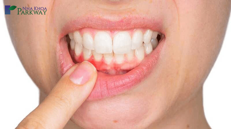 Hình dạng của chân răng lồi ra có thể cho biến nguy cơ ảnh hưởng đến các bệnh lý răng miệng khác