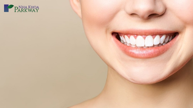Bọc răng sứ là phương pháp có thể điều trị răng khểnh 2 bên ở mức độ nhẹ