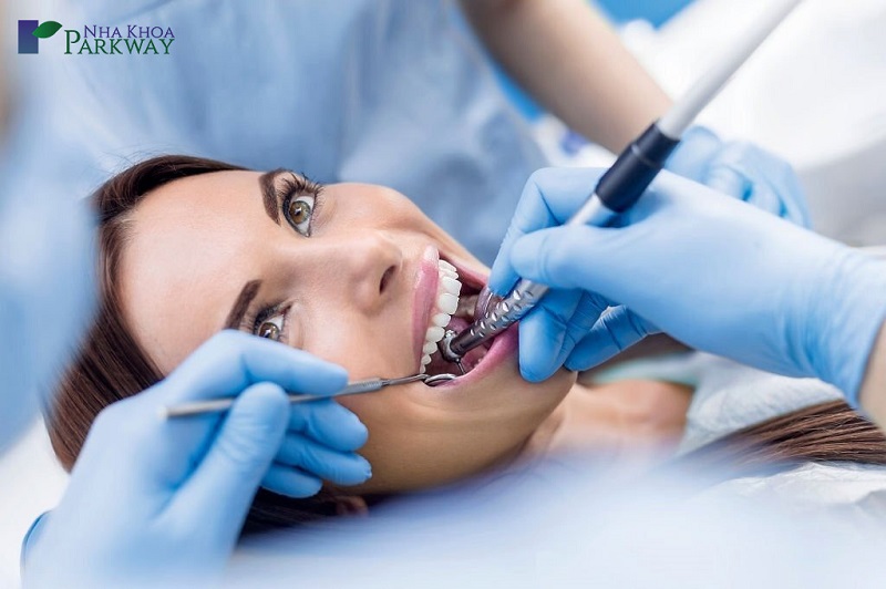 Thời gian niềng răng khểnh 2 bên còn phụ thuộc vào nhiều yếu tố như sức khỏe răng, phương pháp niềng, tay nghề bác sĩ,...