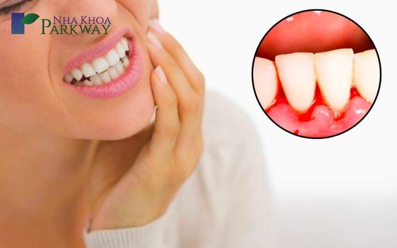Mắc các bệnh về răng miệng dẫn đến sâu răng