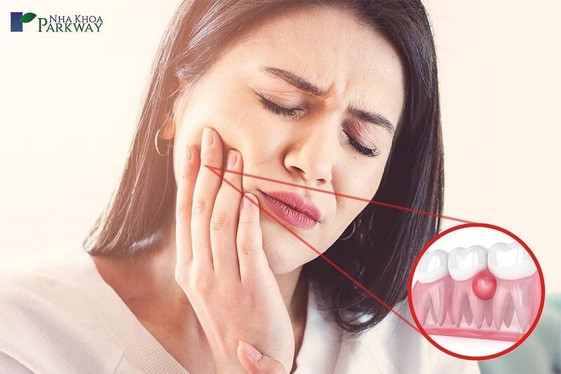 Có nhiều dấu hiệu nhận biết mủ chân răng