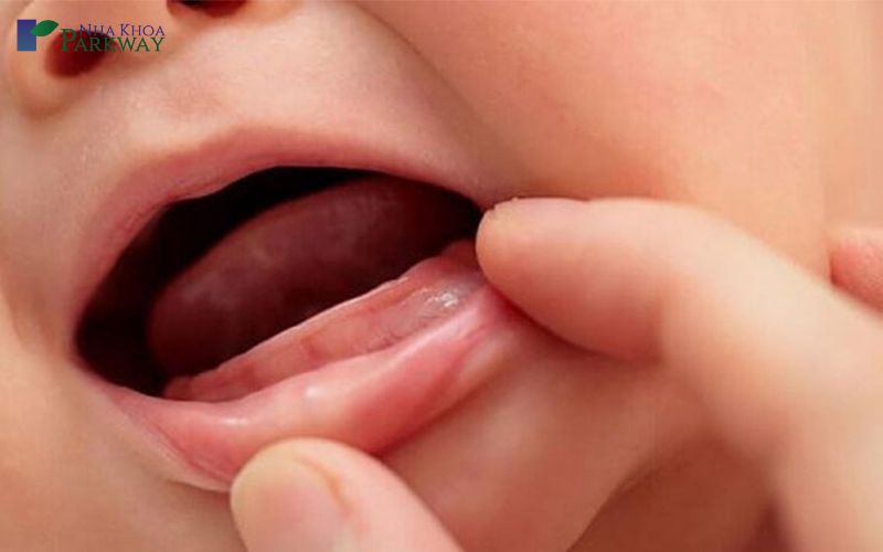 Hình ảnh hàm răng chưa mọc của em bé