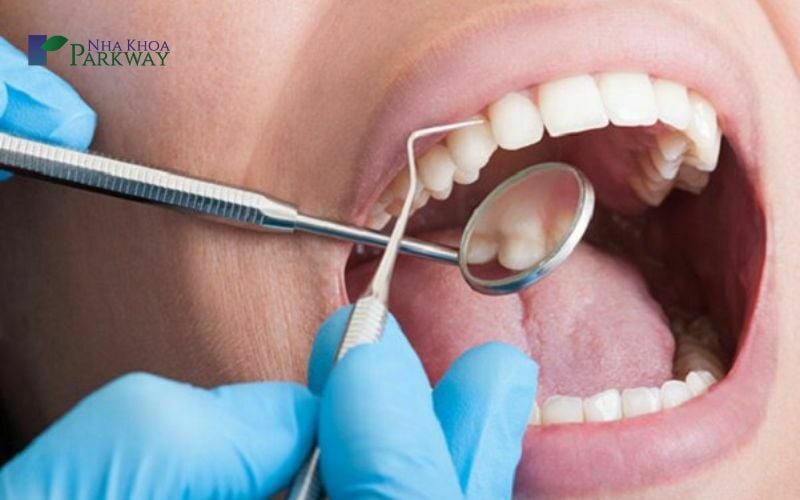 Kiểm tra răng miệng bằng gương và dụng cụ nha khoa chuyên dụng