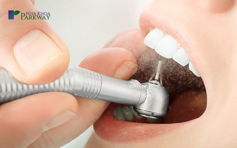 Sử dụng tăm nước nha khoa để vệ sinh răng hàm trên