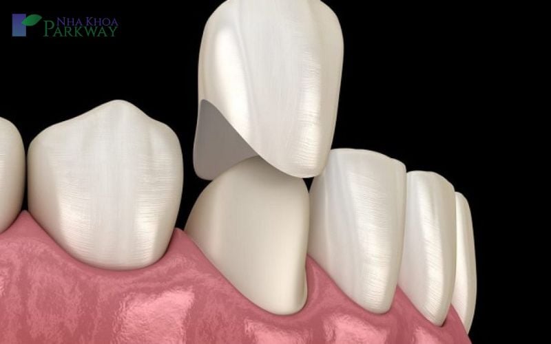 Bọc răng hàm bị sâu có ảnh hưởng đến chất lượng không?