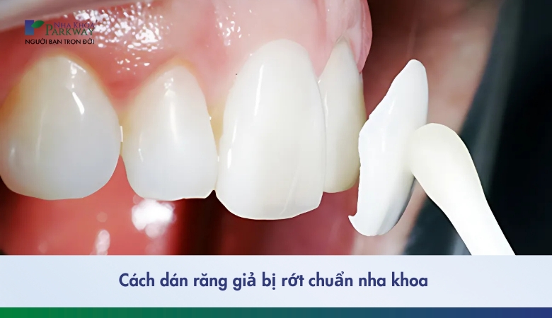Cách dán răng giả bị rớt chuẩn nha khoa - 1