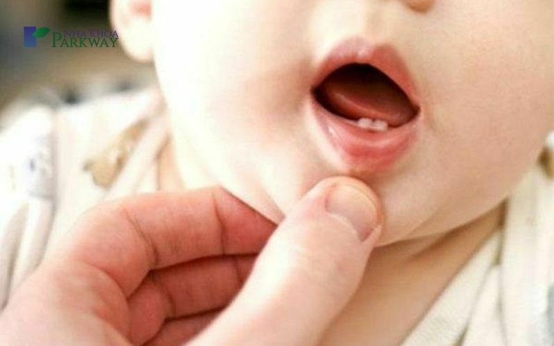 Em bé mọc hai răng sữa hàm dưới