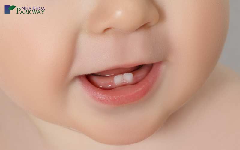 Hình hỉnh răng sữa của em bé
