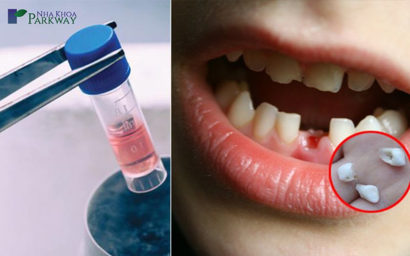 Hình ảnh lưu trữ tế bào gốc và những chiếc răng sửa của trẻ bị gãy
