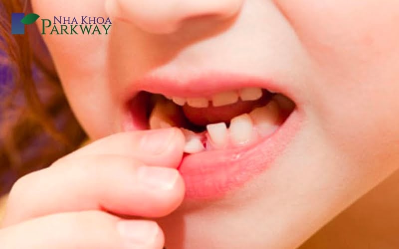 Răng cửa hàm dưới của đứa trẻ bị gãy